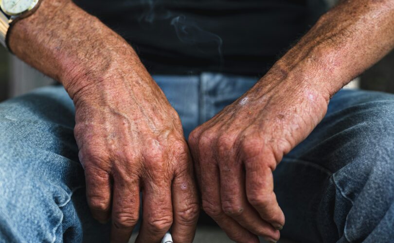 Elderly man's hands resting with a cigarette, representing anticipatory grief and watching someone you love decline
